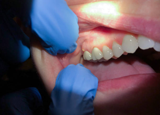 Best Broken Tooth Emergency  in East Dubuque, IL