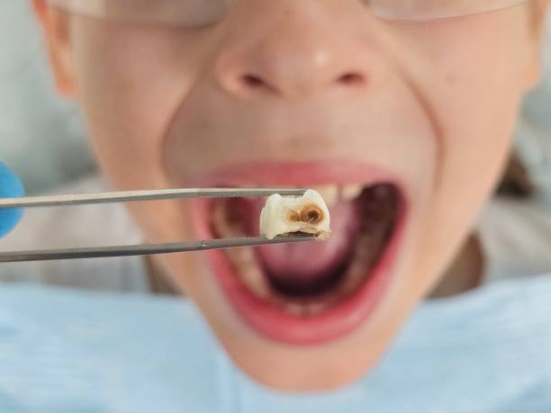 Best Emergency Pediatric Dentist  in East Dubuque, IL